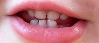 Age One Dental Visit, Why It's Important For Your Baby.
